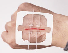 Load image into Gallery viewer, Zipper bandage wound suture patch